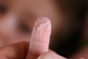 wrinkled finger
