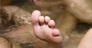 wrinkled toe