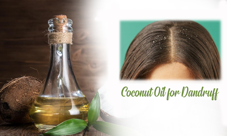 Coconut Oil for Dandruff