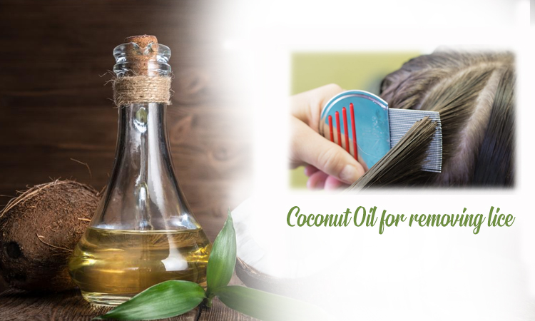 Coconut Oil for Removing Lice