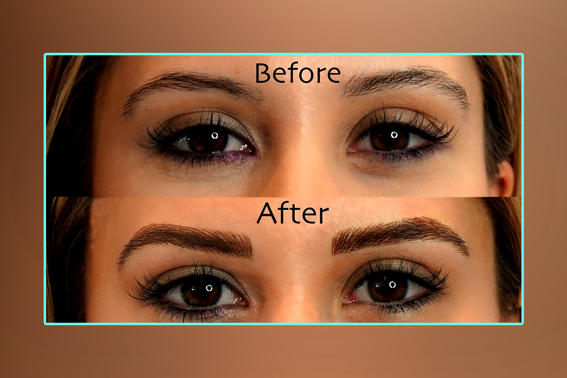 MicroBlading