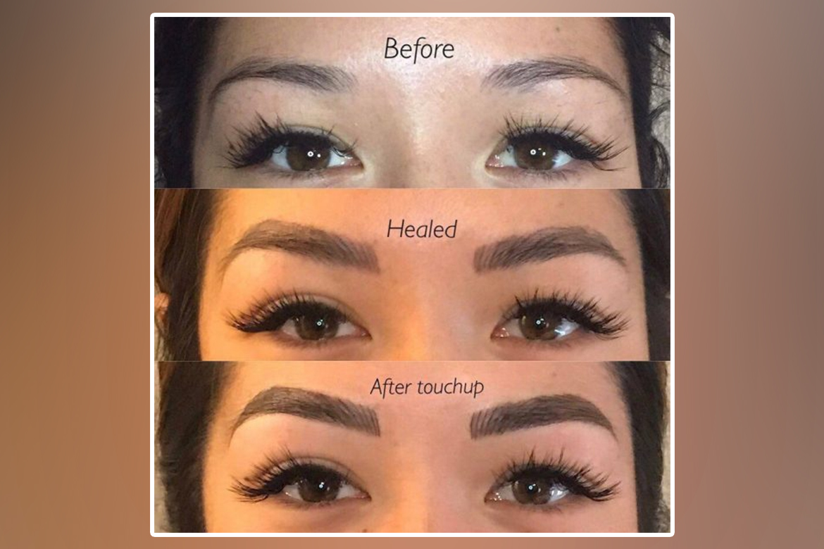 MicroBlading