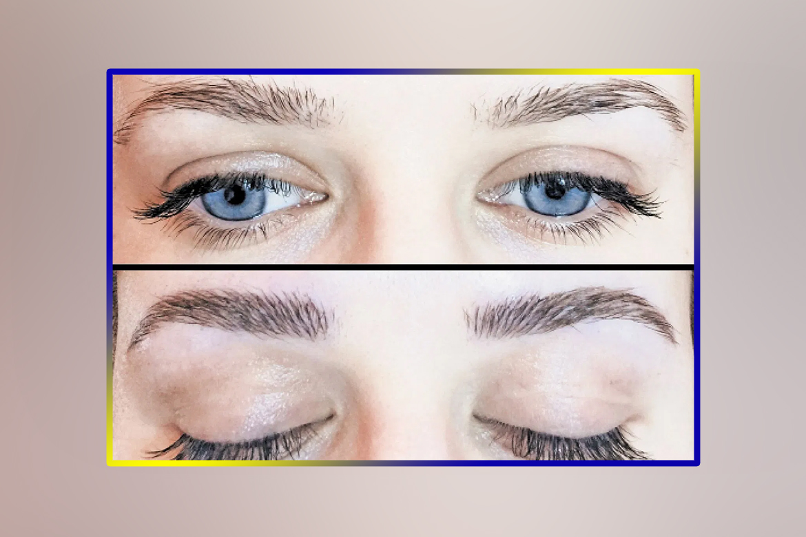 MicroBlading